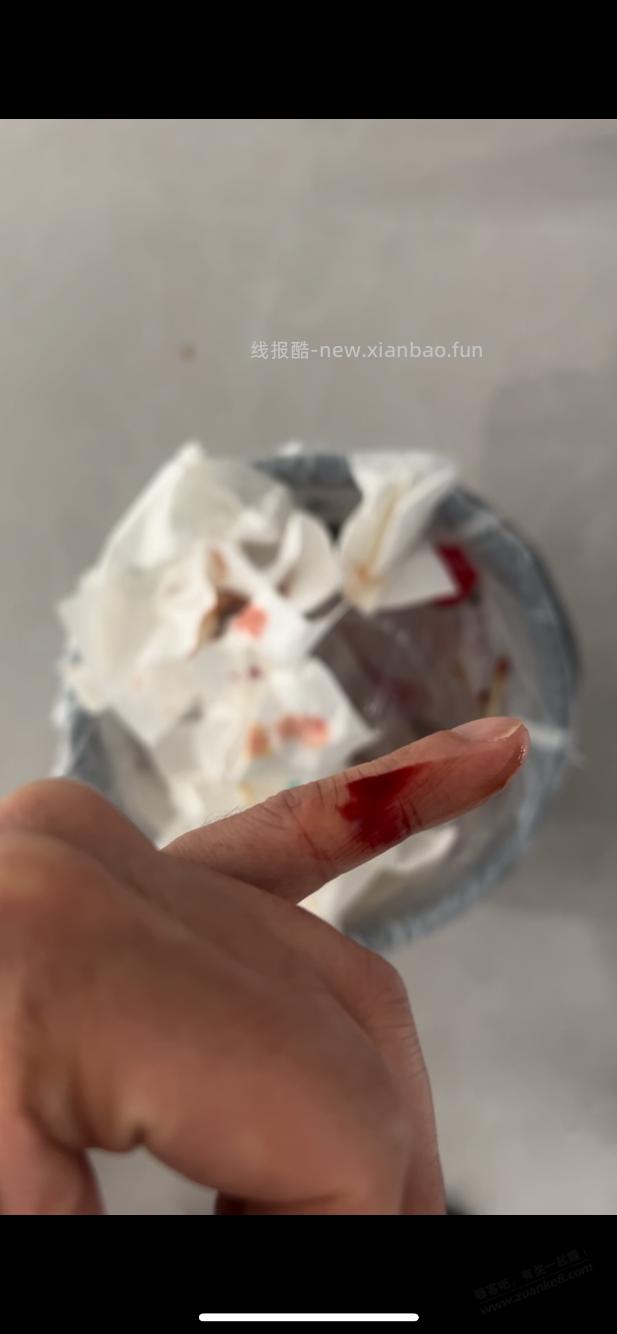 实在抱歉上一个帖子我没说到重点，让大家误会：手划破的事 - 线报酷